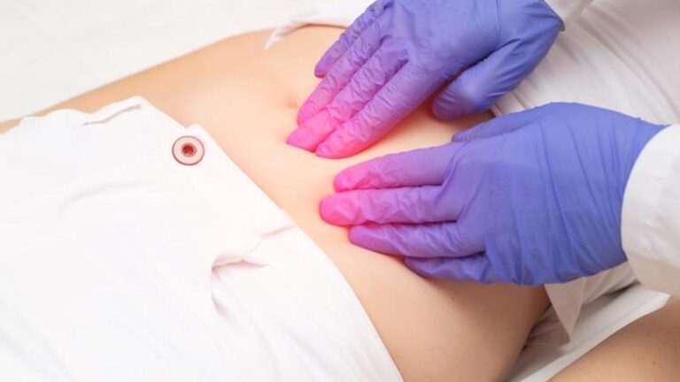 Çikolata kisti belirtileri nelerdir? Çikolata kistini nasıl anlarım? Tedavi yöntemleri nelerdir?